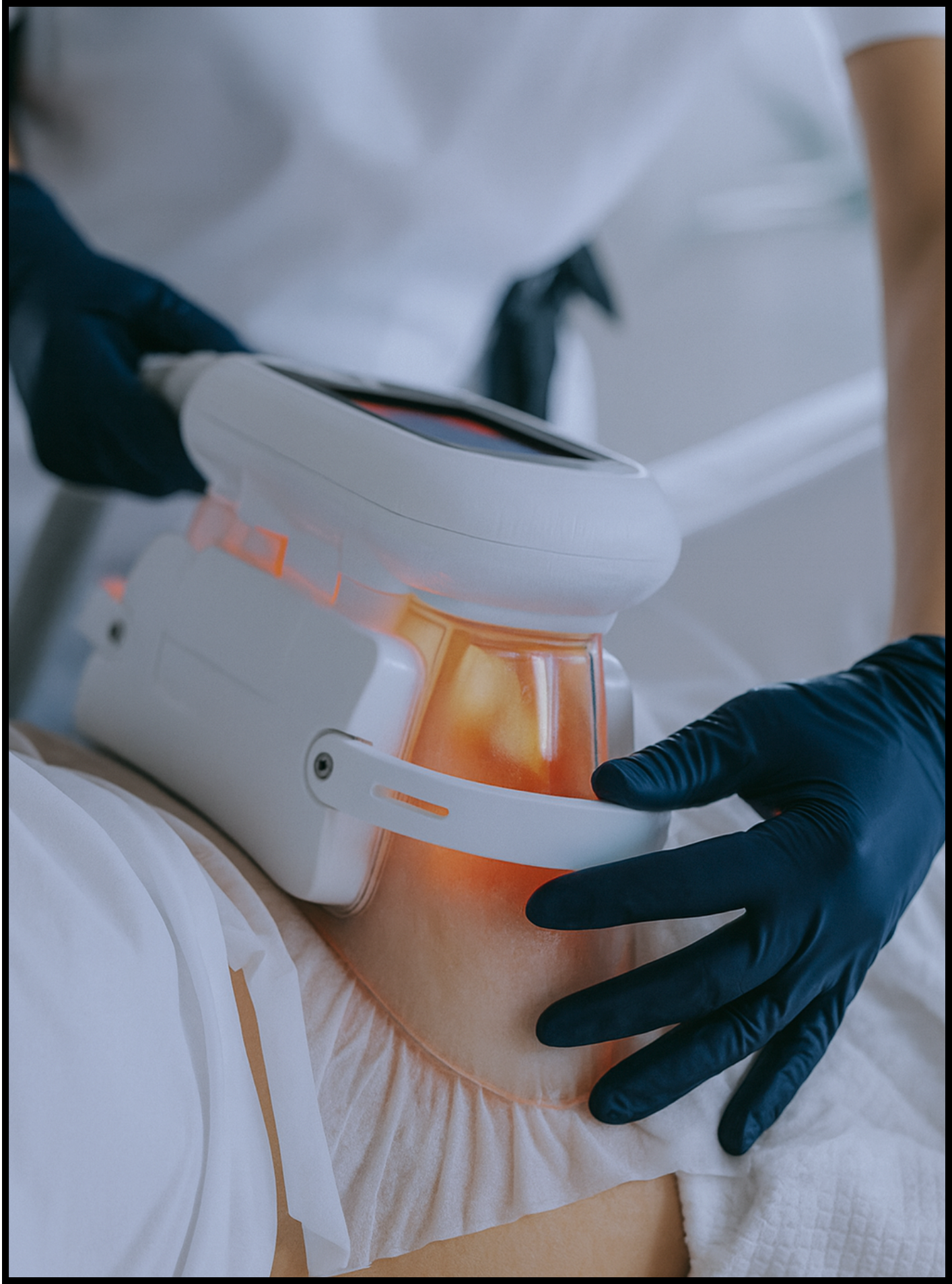 formation Cryolipolyse HD 360°